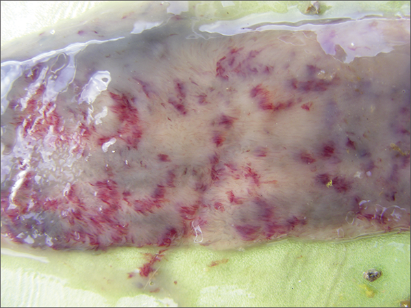 E.maxima_opt.png